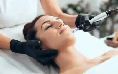 Microneedling – Sanfte Hautverjüngung mit Tiefenwirkung